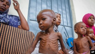 Tragedi Kelaparan di Somalia, Penyebab Ribuan Nyawa Melayang